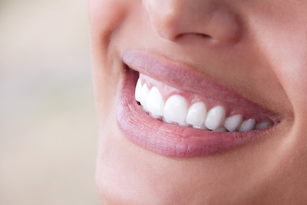 Dental implants could be right for you