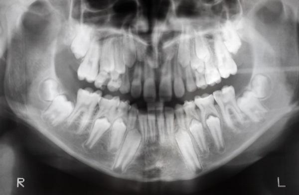 Digital Images and Dentistry