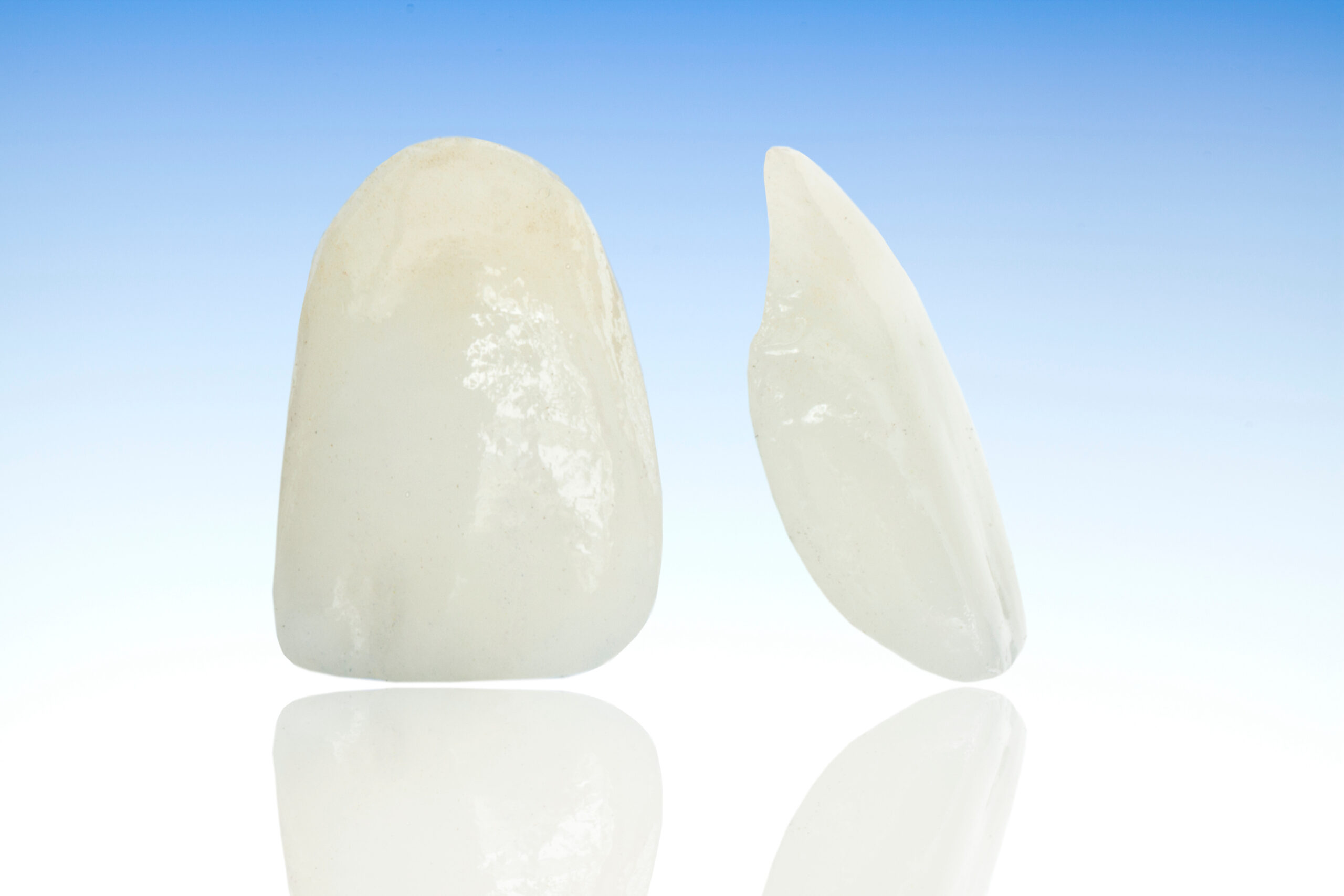 Can You Get Veneers with Crooked Teeth?