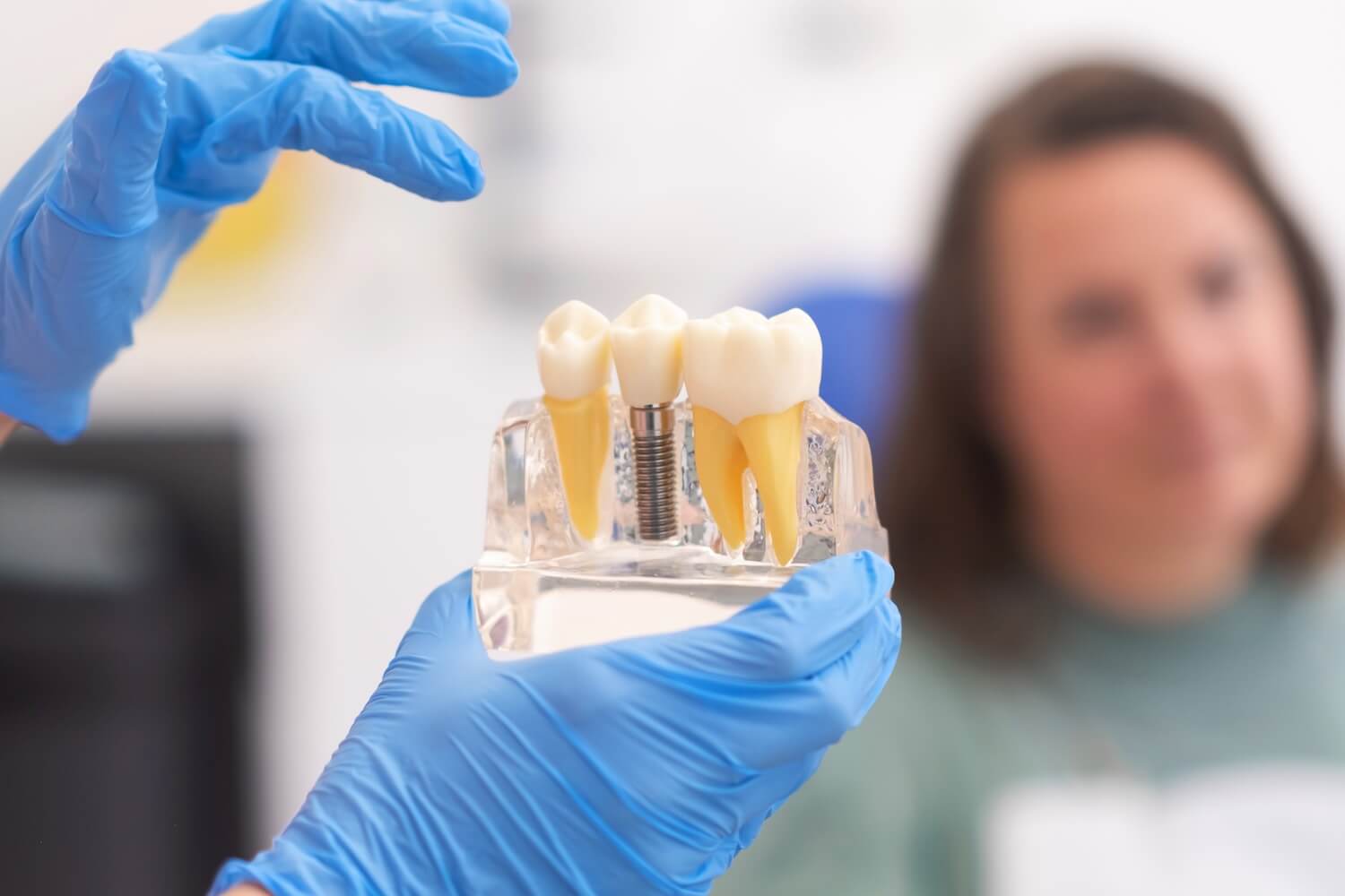Cost of Confidence: Understanding Dental Implants’ Investment vs. Value