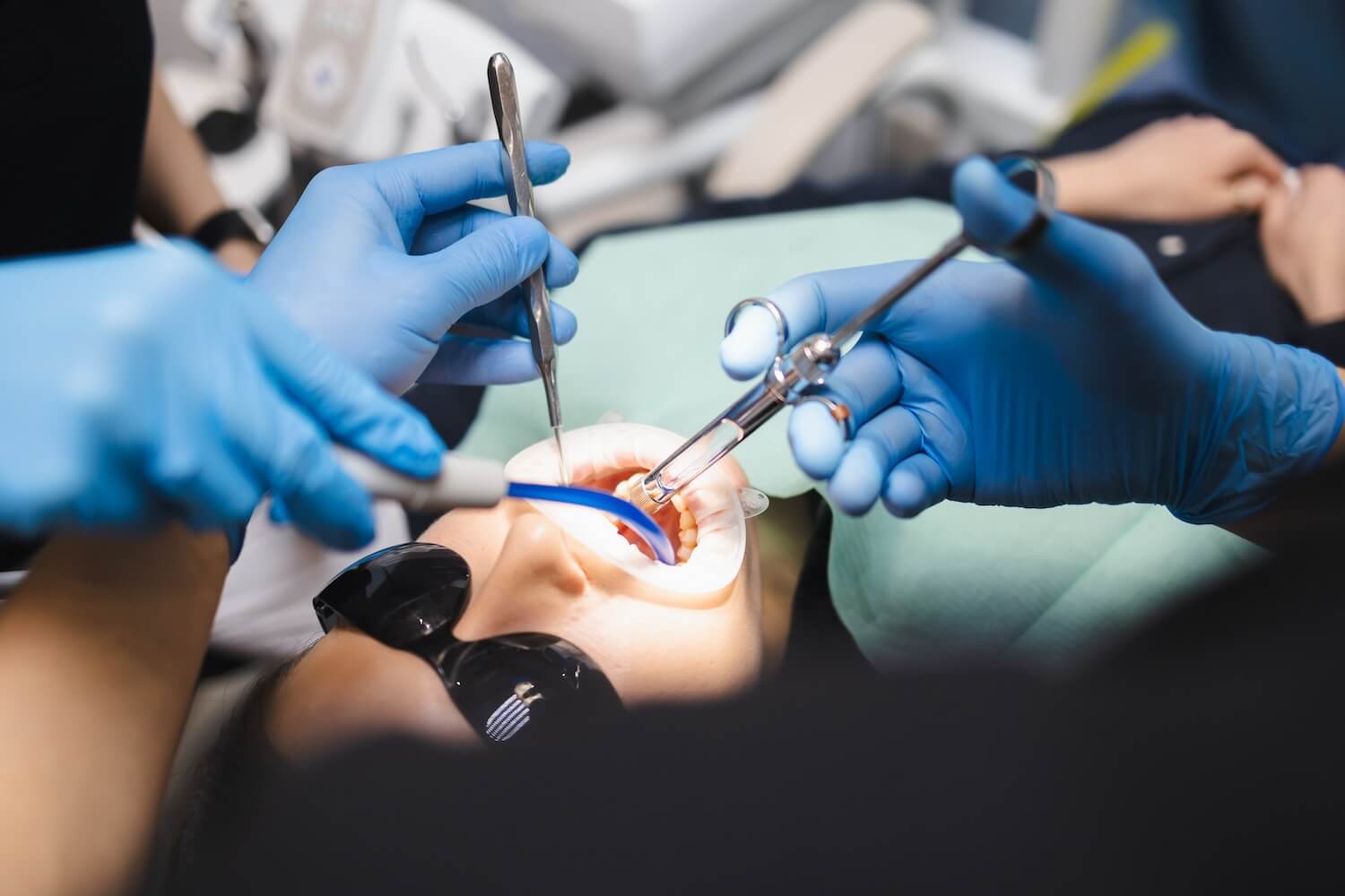 The Science Behind PRP: Achieve Faster Recovery After Tooth Extraction